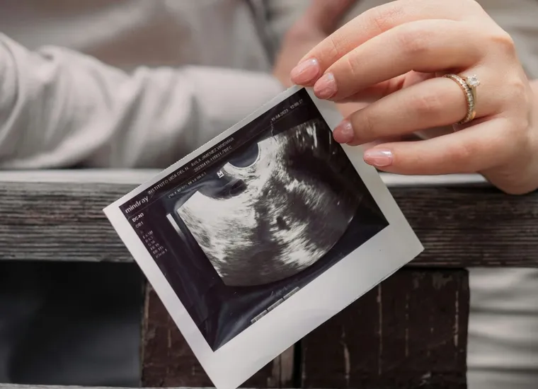 Portable Ultrasound Devices: Revolutionizing Healthcare with Mobility and Accessibility