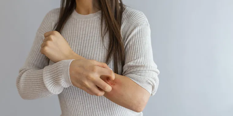 Plaque Psoriasis: Causes, Remedies, and Preventions