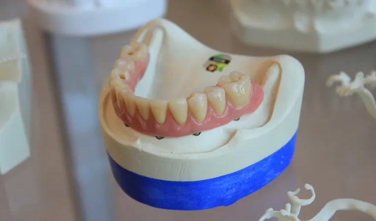 Dentaduras postizas para personas mayores: opciones asequibles y confiables para una sonrisa segura