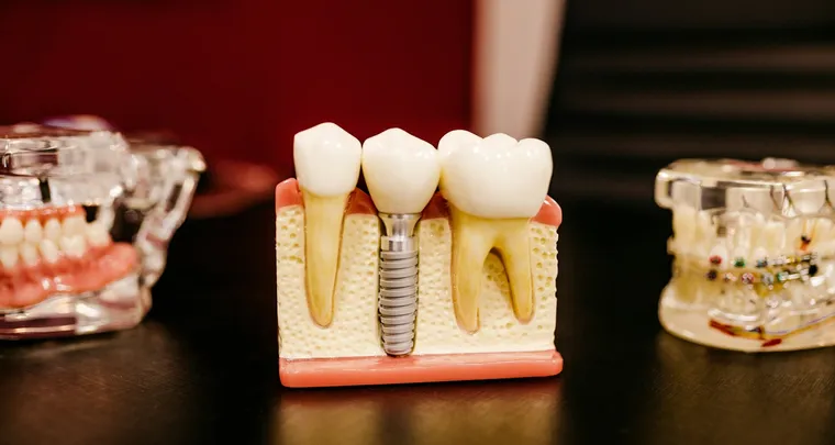 Discover comprehensive dental insurance plans for seniors.