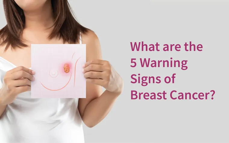 Signs of Breast Cancer: Early Symptoms Every Woman Should Know for Timely Detection